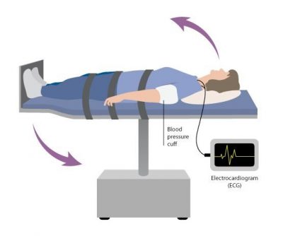 Tilt-test para avaliação de desmaio e síncope em Maringá